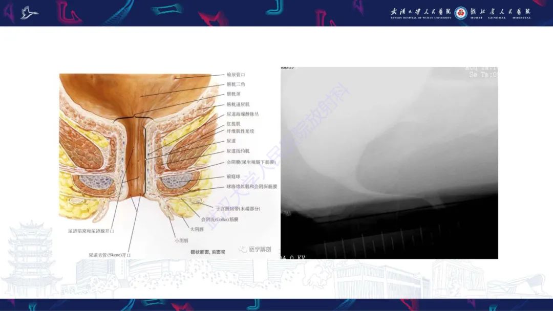【PPT】尿道造影疾病诊断-5