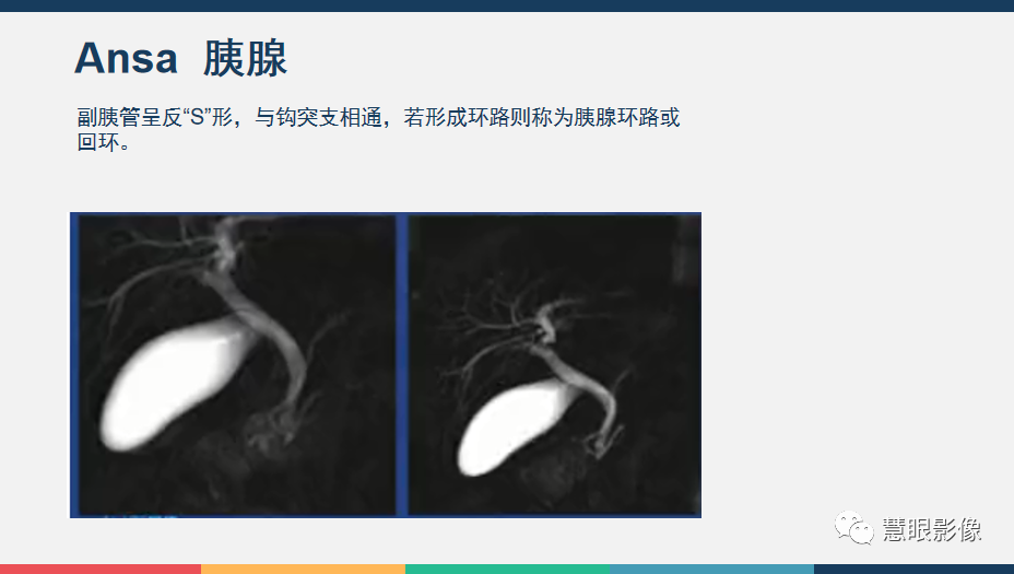 【PPT】胰腺解剖变异、发育异常及相关病变影像评估-11