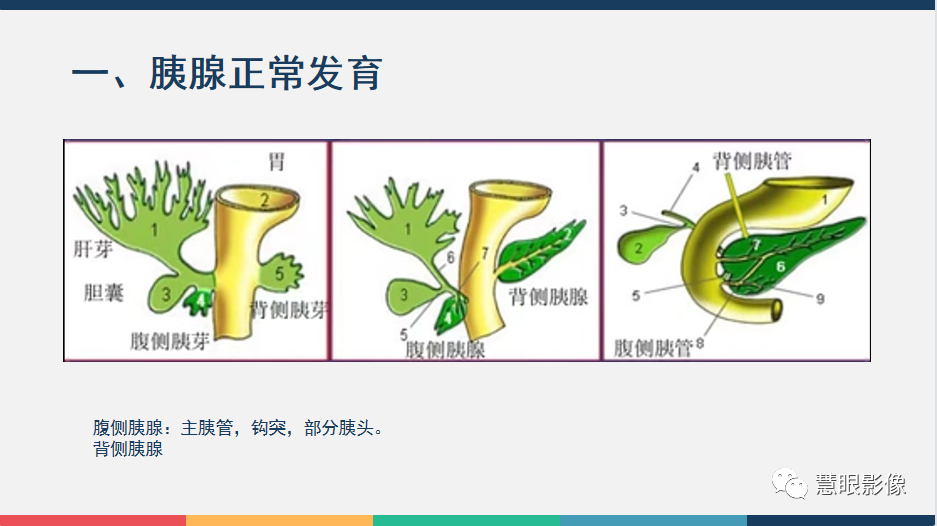【PPT】胰腺解剖变异、发育异常及相关病变影像评估-3