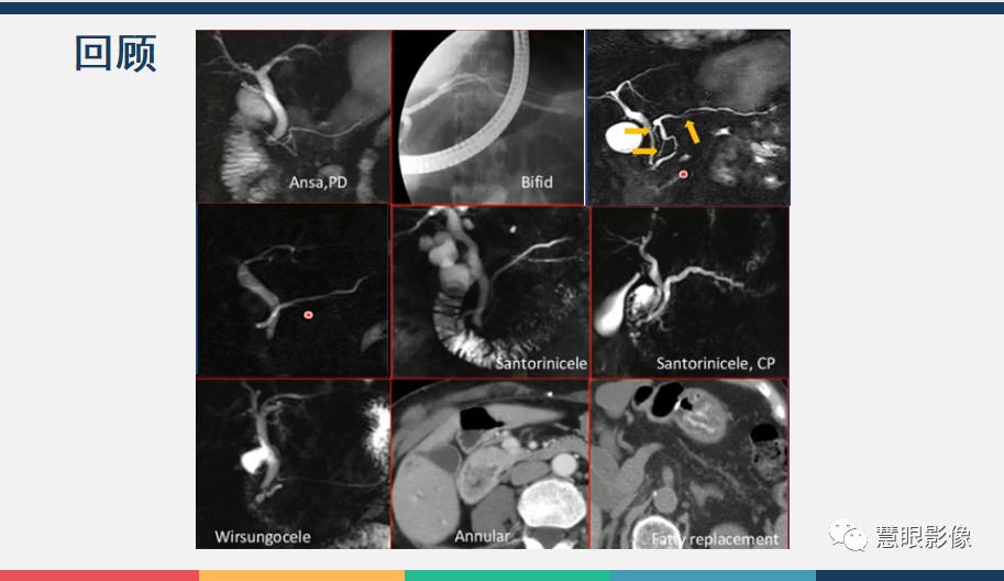 【PPT】胰腺解剖变异、发育异常及相关病变影像评估-33