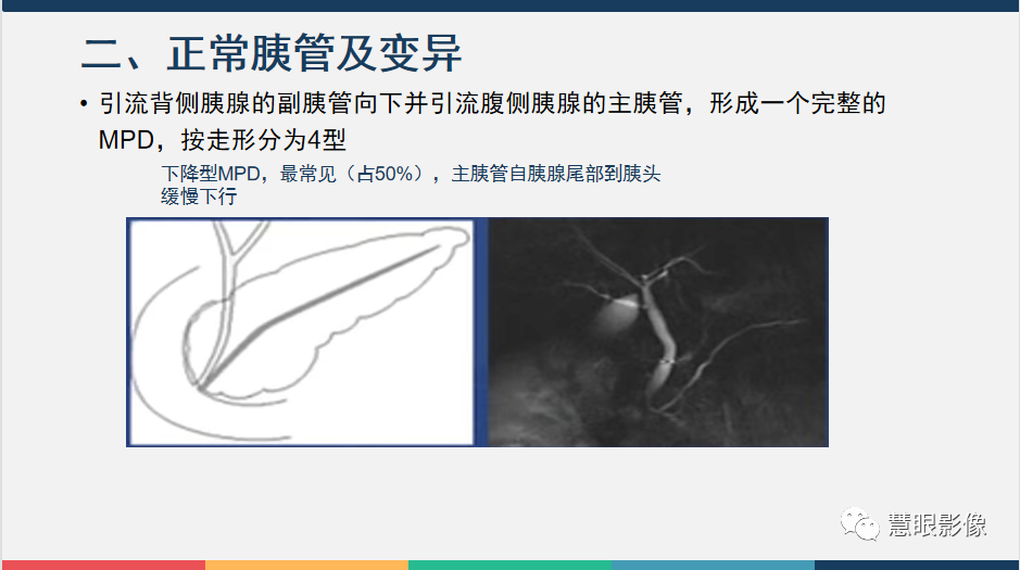 【PPT】胰腺解剖变异、发育异常及相关病变影像评估-6