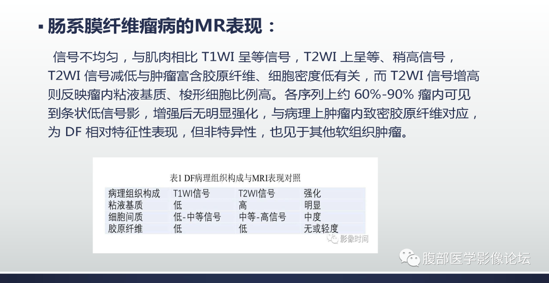 【病例】肠系膜侵袭性纤维瘤病1例MR影像-11