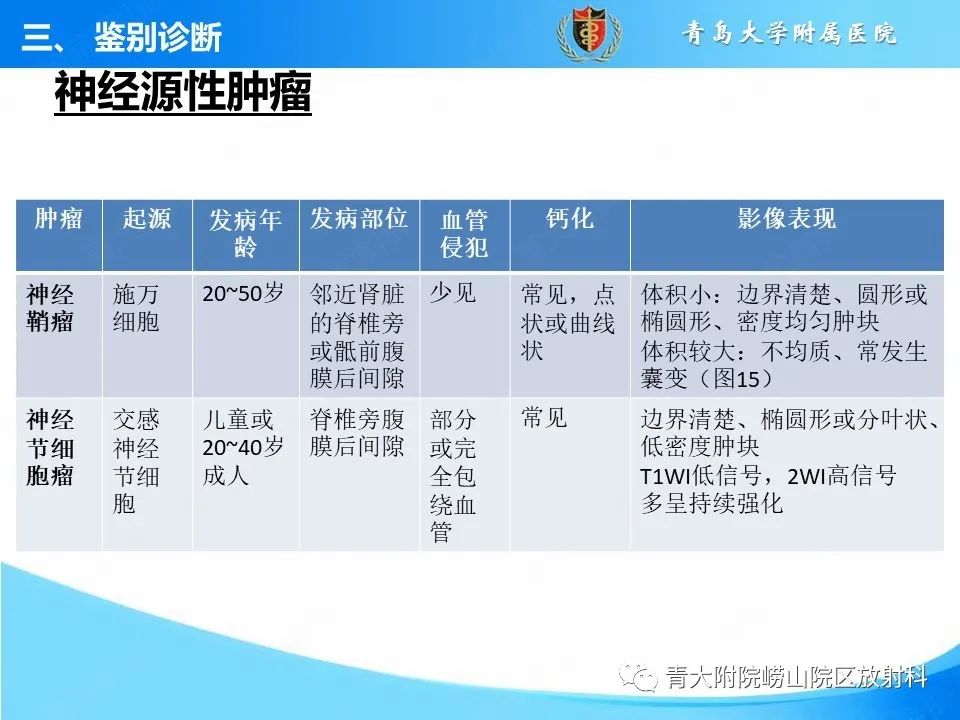 【病例】腹膜后副神经节瘤1例CT影像-39