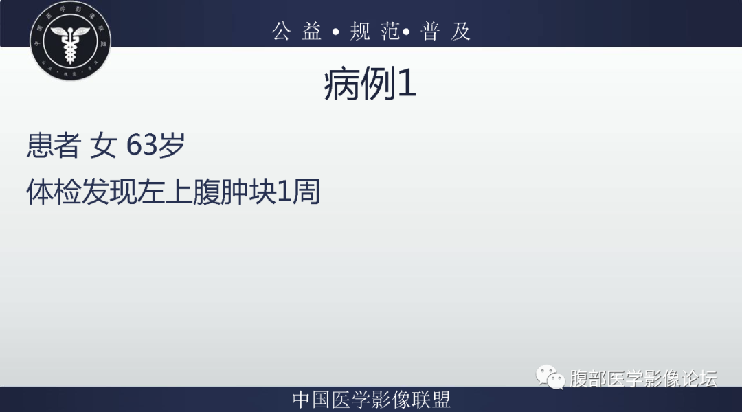 【病例】腹膜后副神经节瘤1例CT影像-2