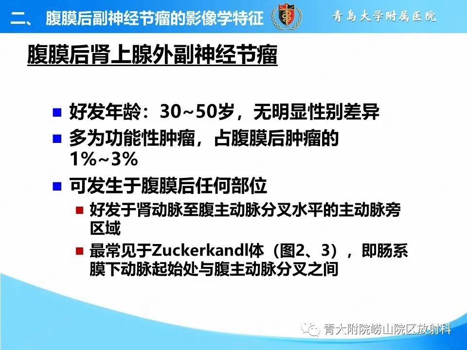 【病例】腹膜后副神经节瘤1例CT影像-23