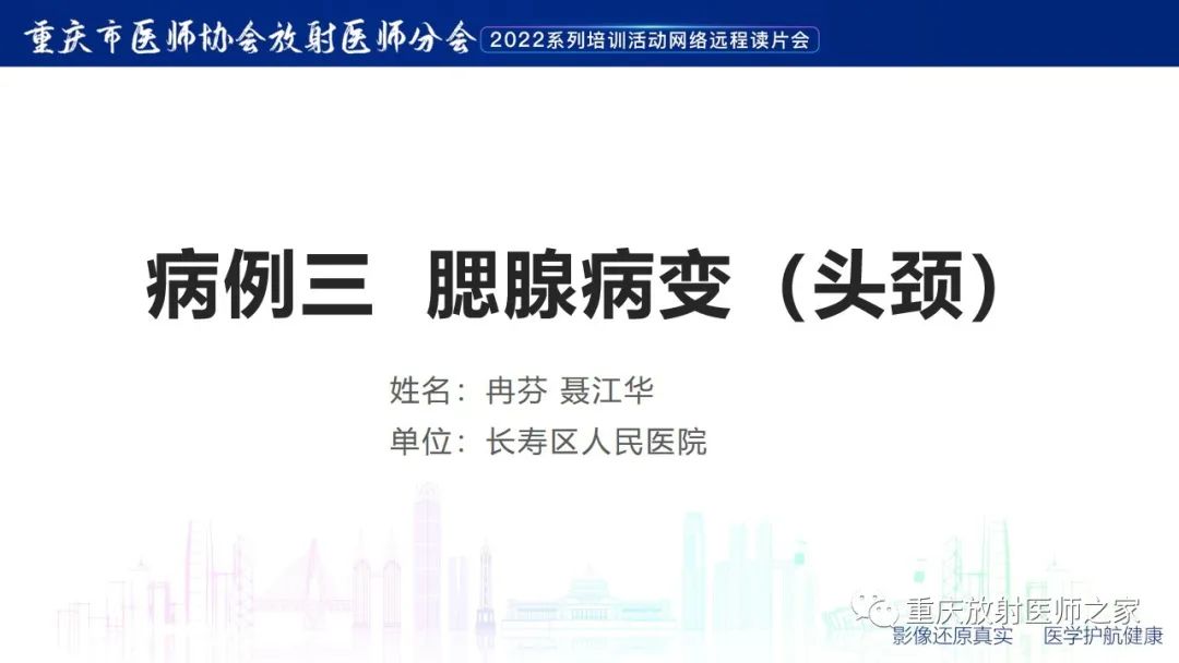 【病例】腮腺腺淋巴瘤1例CT影像-1