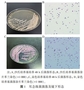 耳念珠菌致血流感染1例
