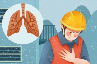 咳嗽、咯血、呼吸困难……肺癌患者的4种典型症状如