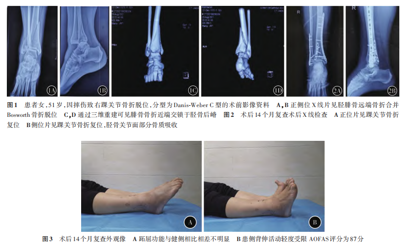 图1.png