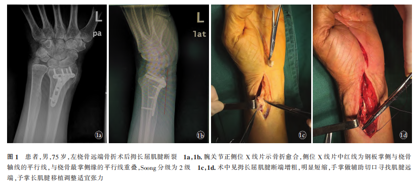 图1.png