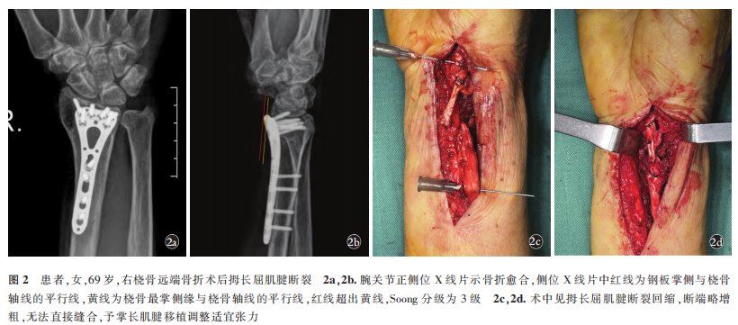 图2.png