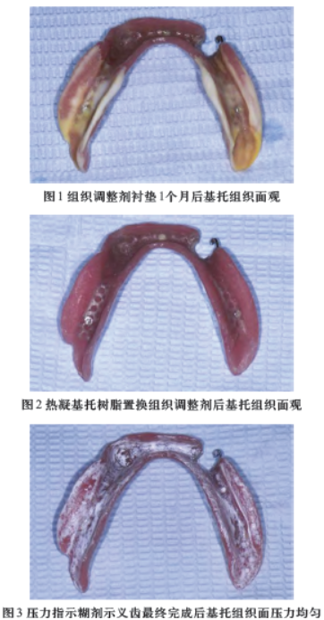 放讨论前.png