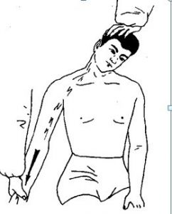 臂丛神经牵拉试验