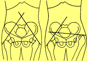 休梅克(Shoemaker)氏线