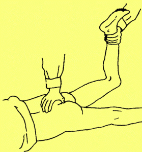 髋关节过伸试验