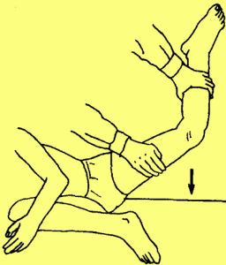 髂胫束挛缩试验(Ober试验)