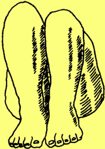 艾利斯(Allis)氏征