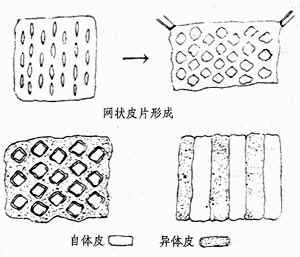 热烧伤
