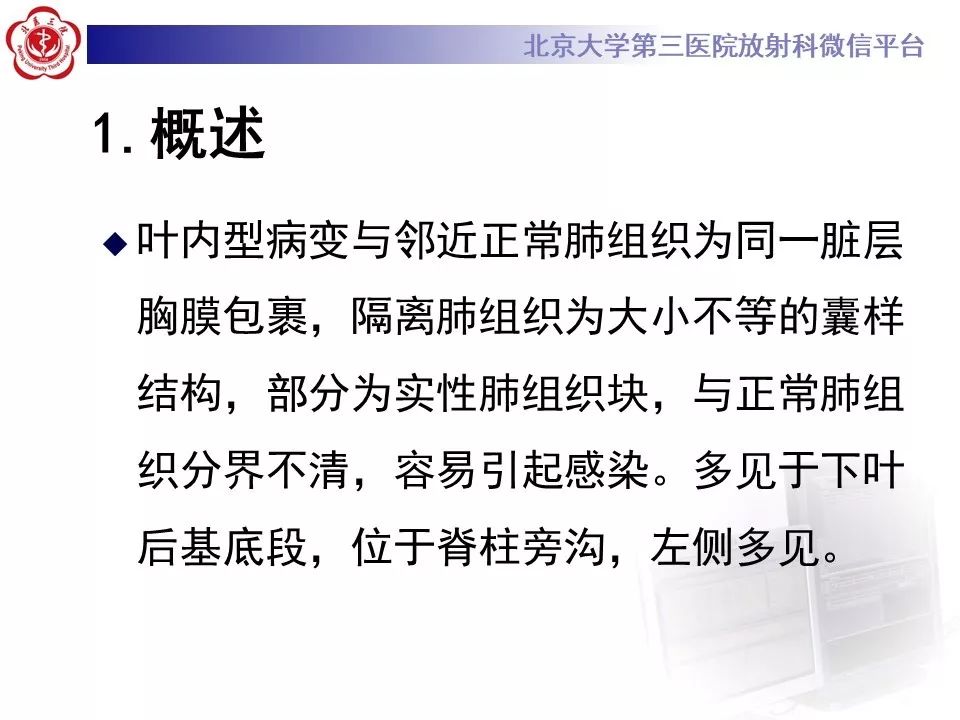 【PPT】肺隔离症的影像
