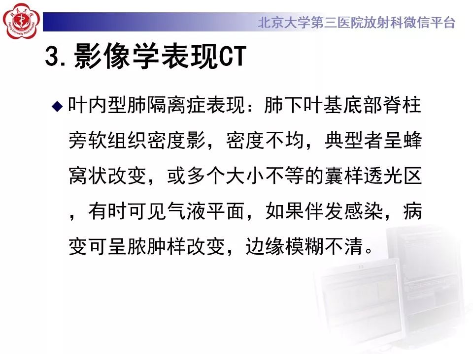 【PPT】肺隔离症的影像