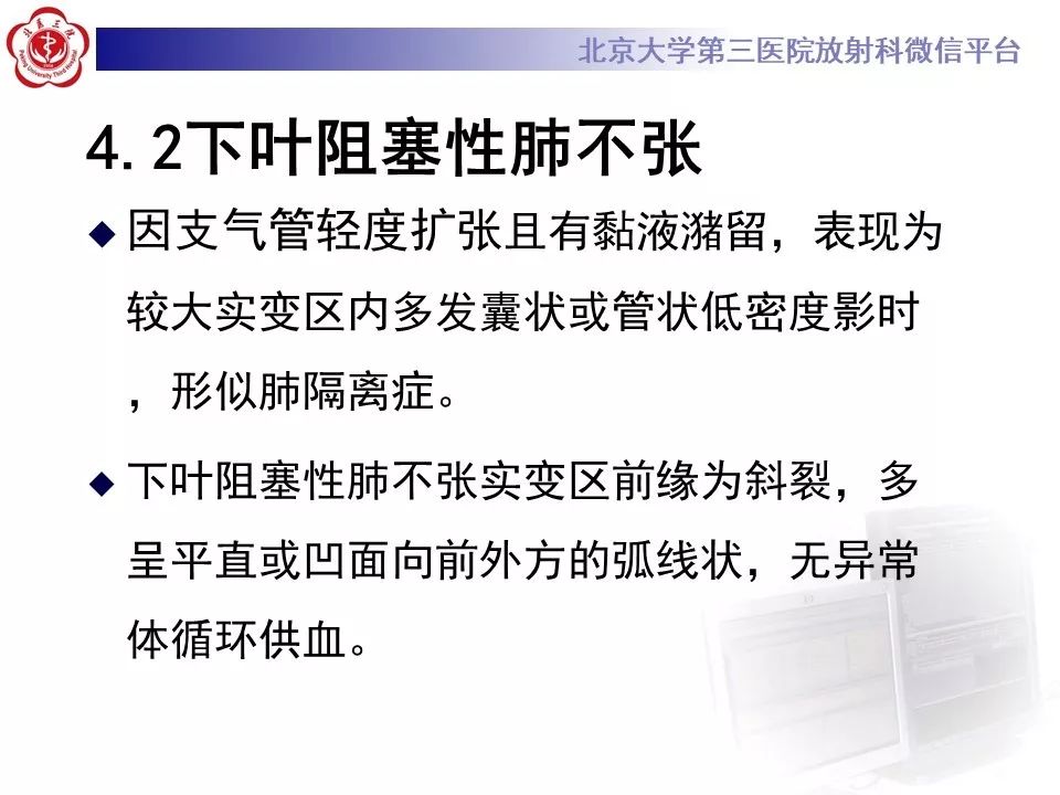 【PPT】肺隔离症的影像