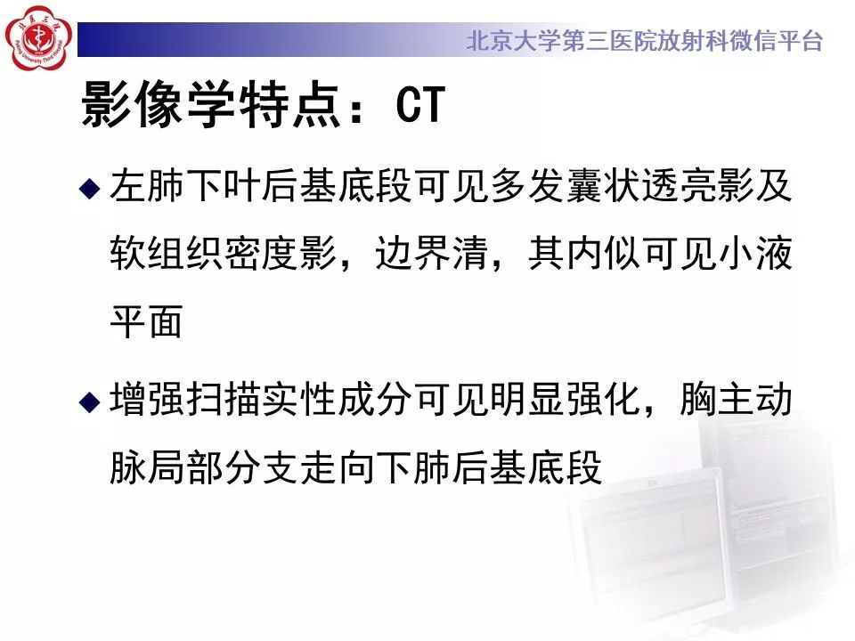 【PPT】肺隔离症的影像