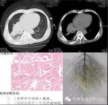 典型影像征象收集