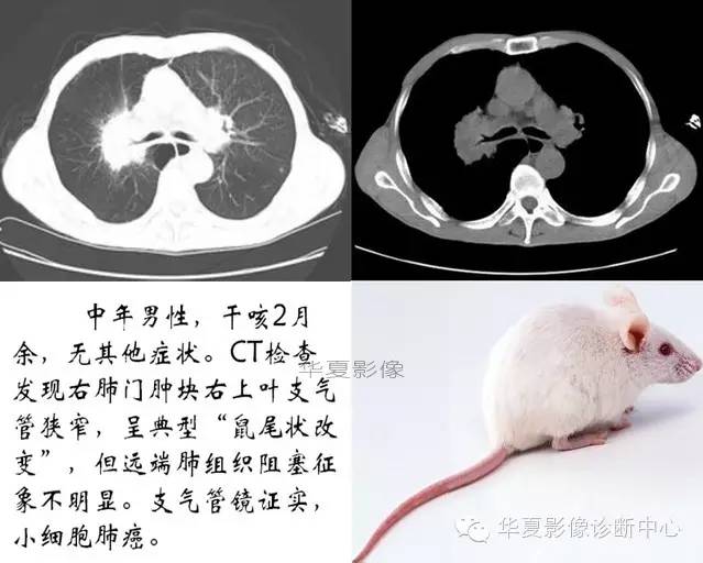 典型影像征象收集