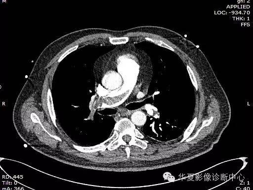 典型影像征象收集