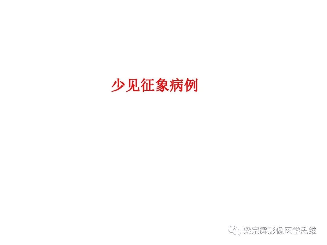 【PPT】山西新型冠状病毒肺炎影像学表现初探