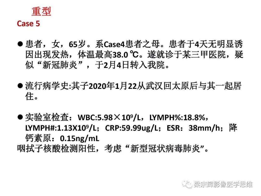 【PPT】山西新型冠状病毒肺炎影像学表现初探