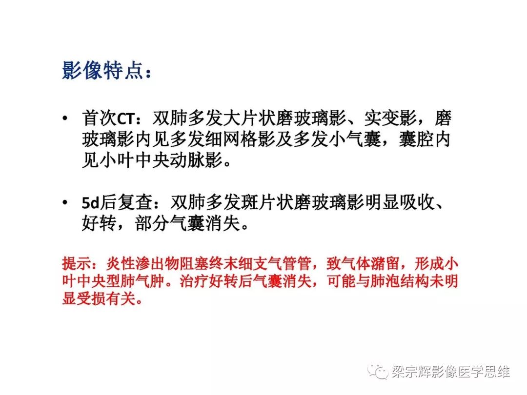 【PPT】山西新型冠状病毒肺炎影像学表现初探
