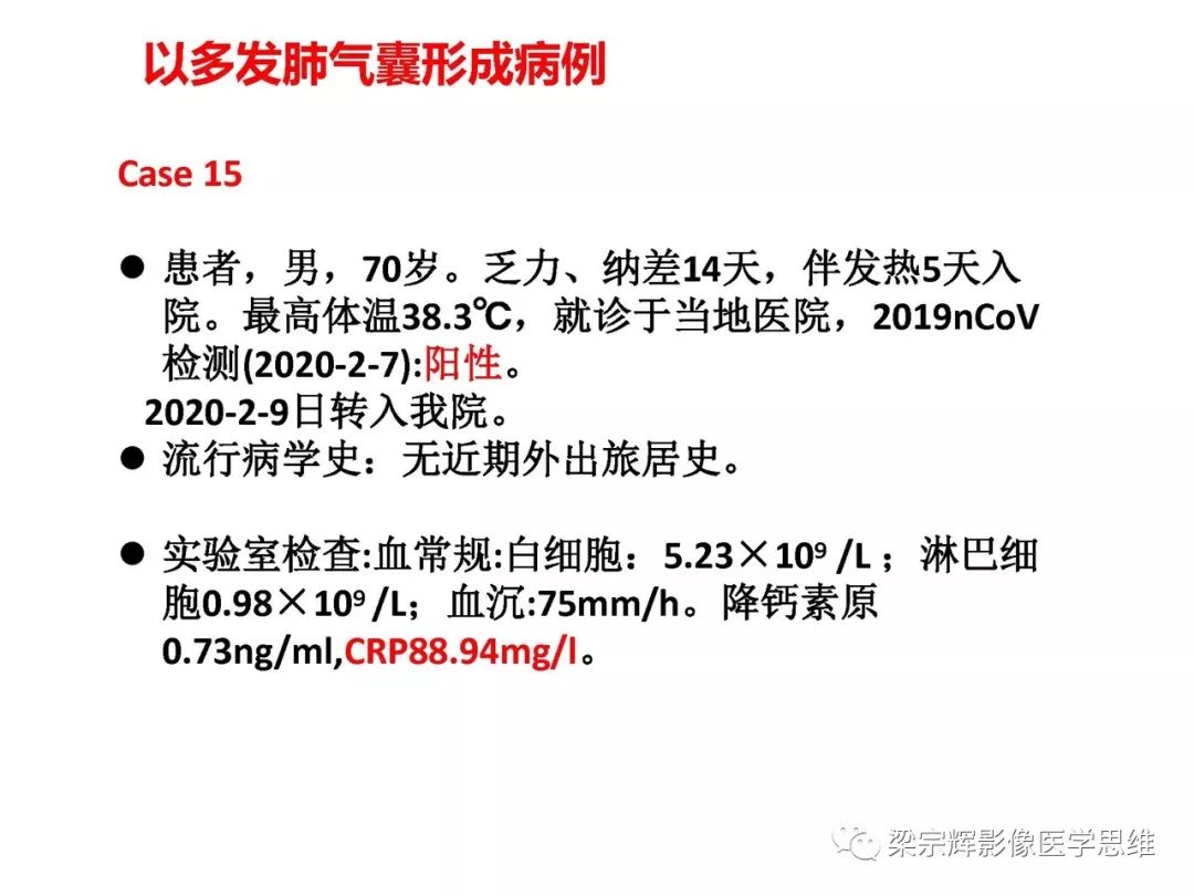 【PPT】山西新型冠状病毒肺炎影像学表现初探