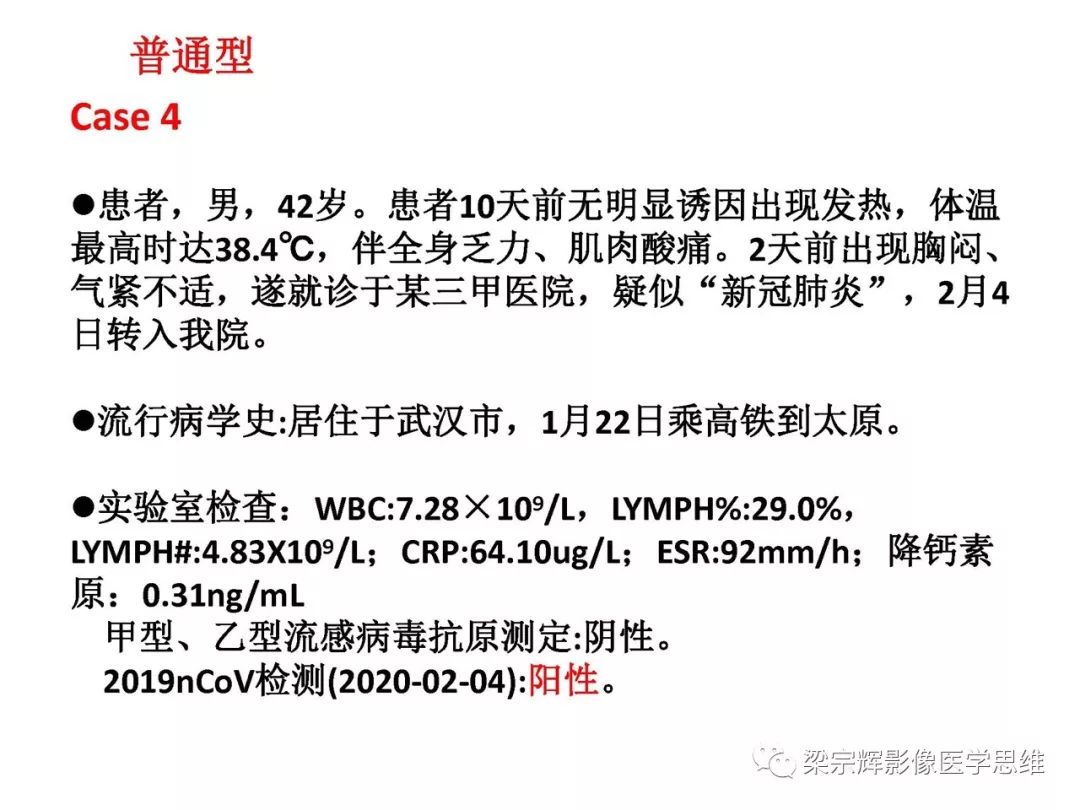 【PPT】山西新型冠状病毒肺炎影像学表现初探