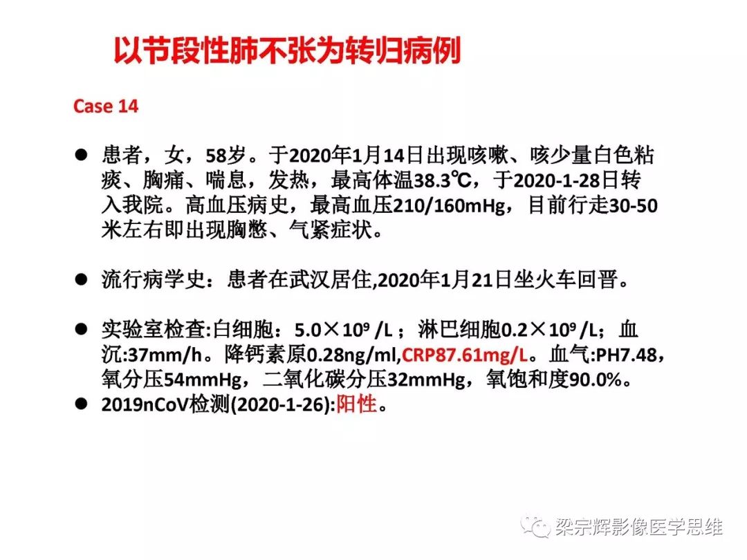 【PPT】山西新型冠状病毒肺炎影像学表现初探