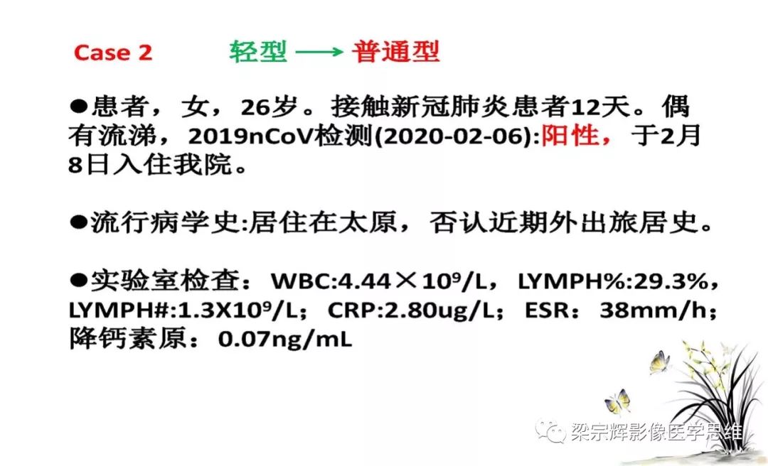 【PPT】山西新型冠状病毒肺炎影像学表现初探