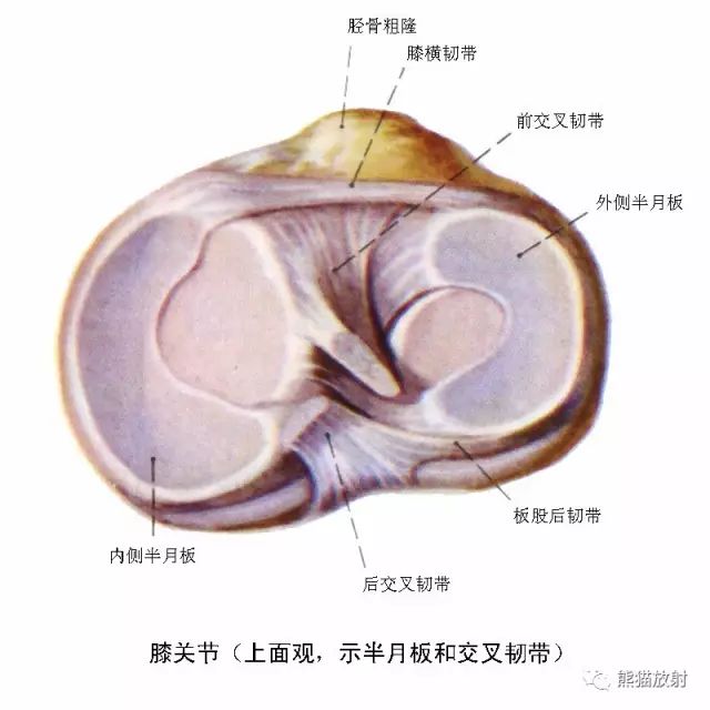 前交叉韧带损伤MRI 征象