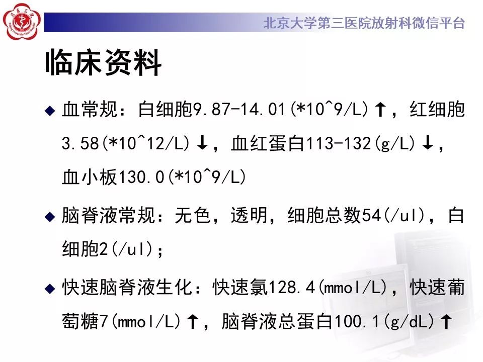 【PPT】中毒性脑病的影像