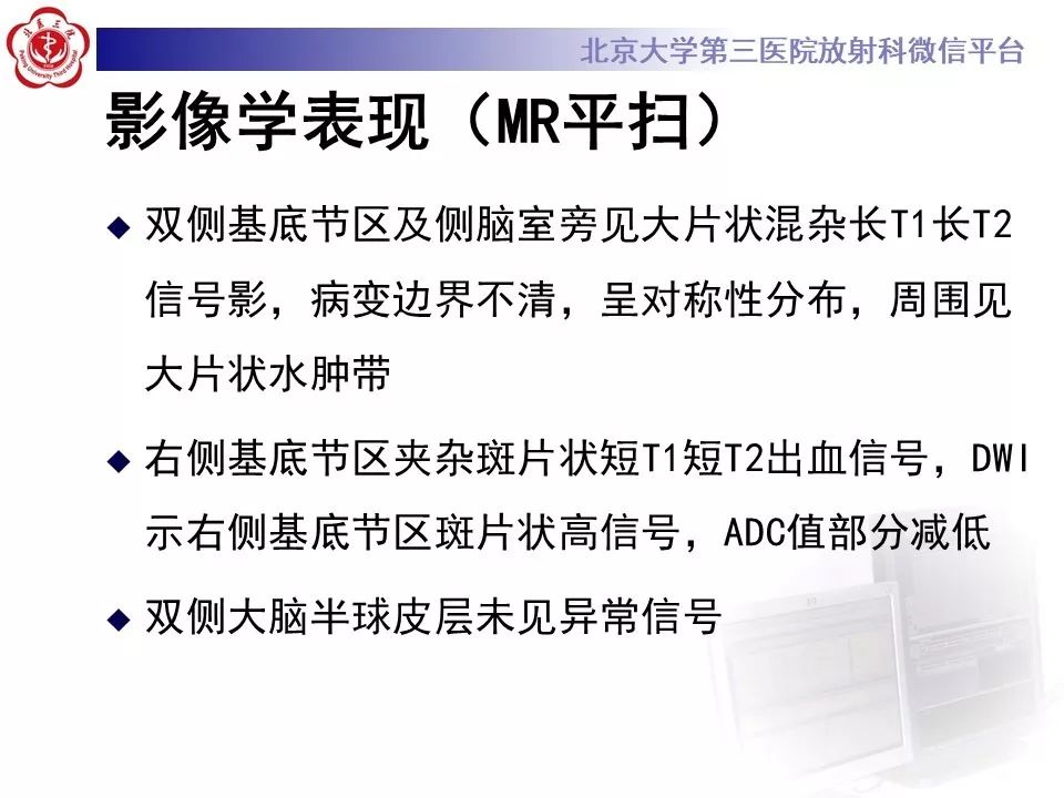 【PPT】中毒性脑病的影像