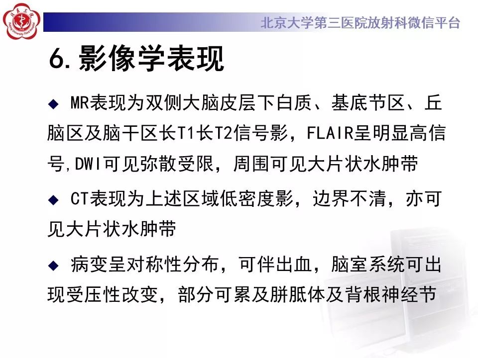 【PPT】中毒性脑病的影像