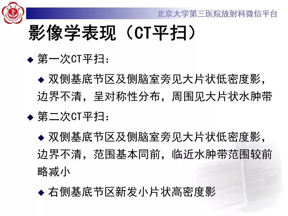 【PPT】中毒性脑病的影像