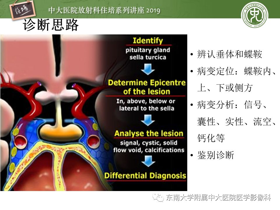 【PPT】垂体正常及常见疾病影像表现