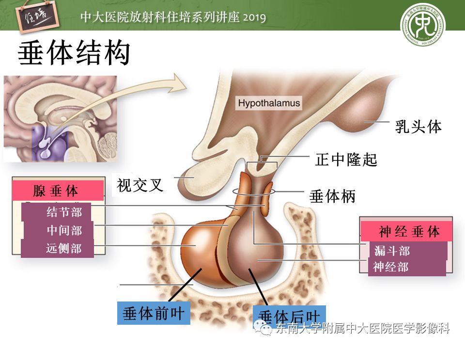 【PPT】垂体正常及常见疾病影像表现