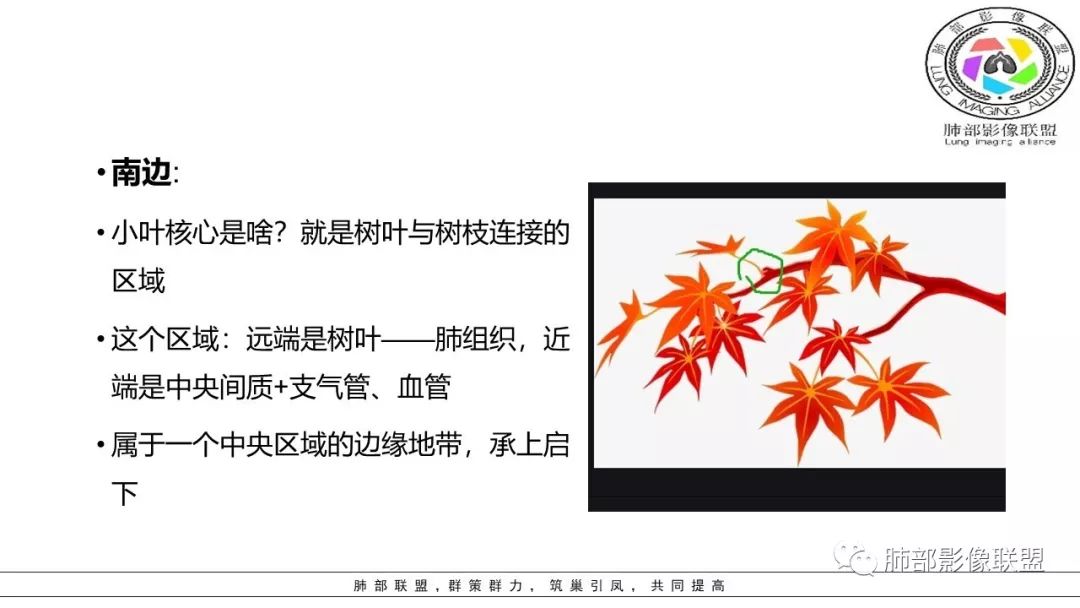 【PPT】病毒肺炎影像机制探讨
