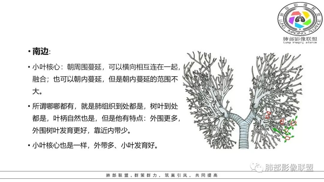 【PPT】病毒肺炎影像机制探讨