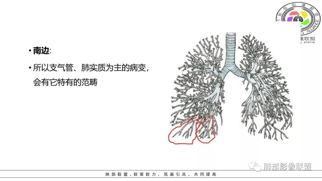 【PPT】病毒肺炎影像机制探讨