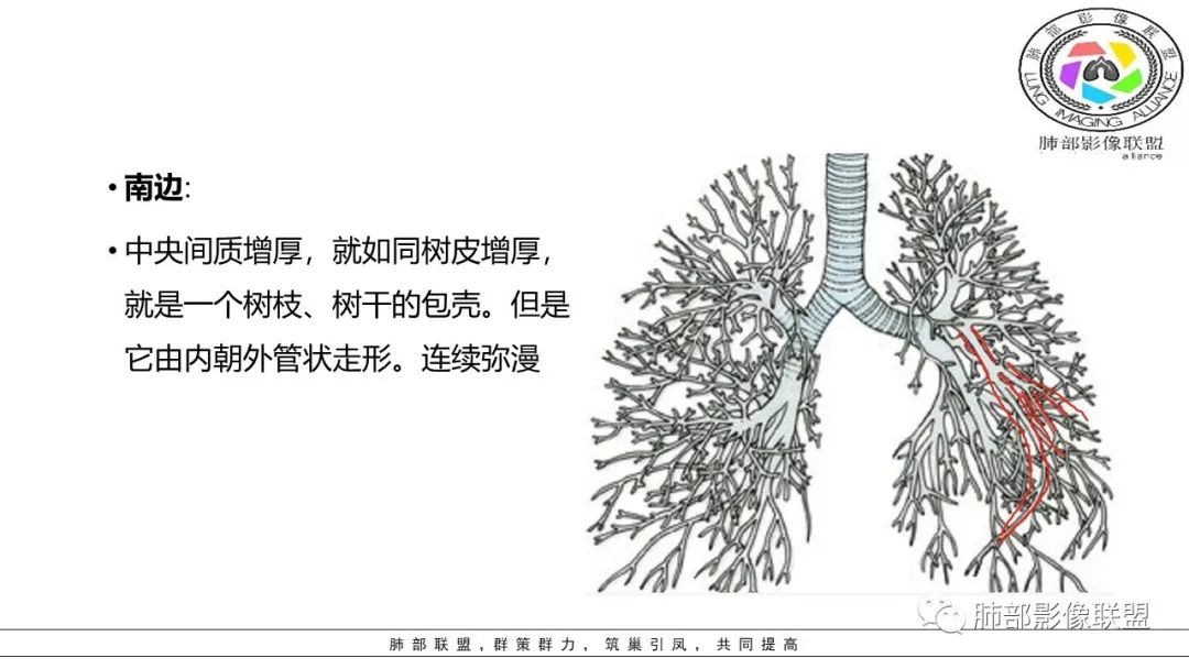 【PPT】病毒肺炎影像机制探讨