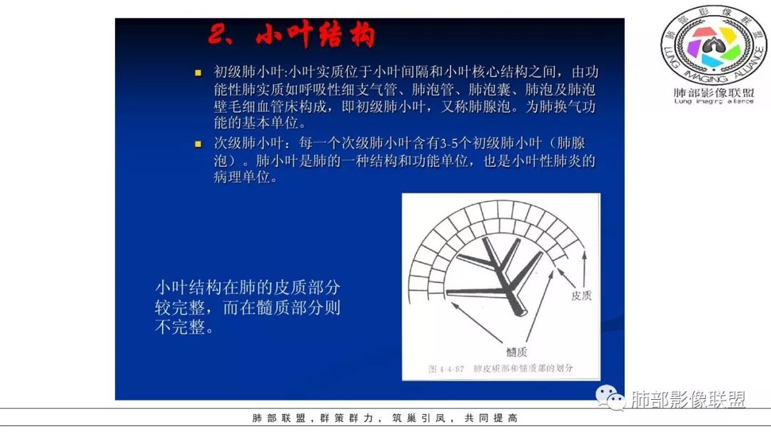 【PPT】病毒肺炎影像机制探讨