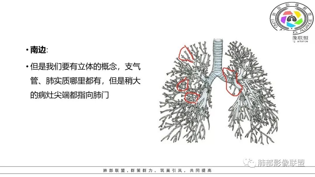 【PPT】病毒肺炎影像机制探讨