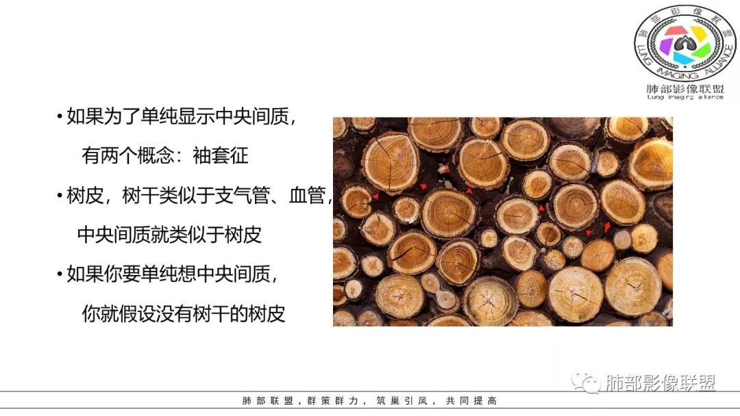 【PPT】病毒肺炎影像机制探讨